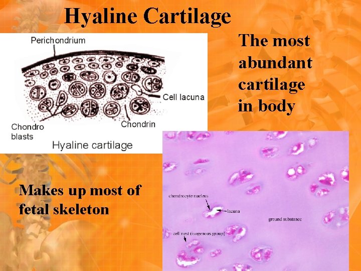 Hyaline Cartilage The most abundant cartilage in body Makes up most of fetal skeleton