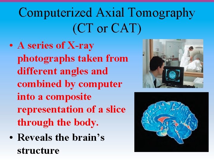 Computerized Axial Tomography (CT or CAT) • A series of X-ray photographs taken from