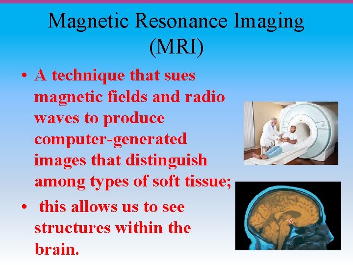 Magnetic Resonance Imaging (MRI) • A technique that sues magnetic fields and radio waves