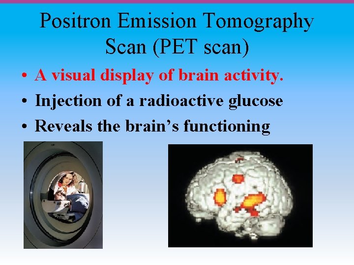 Positron Emission Tomography Scan (PET scan) • A visual display of brain activity. •