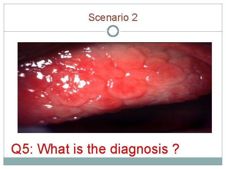 Scenario 2 Q 5: What is the diagnosis ? 