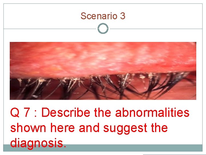 Scenario 3 Q 7 : Describe the abnormalities shown here and suggest the diagnosis.