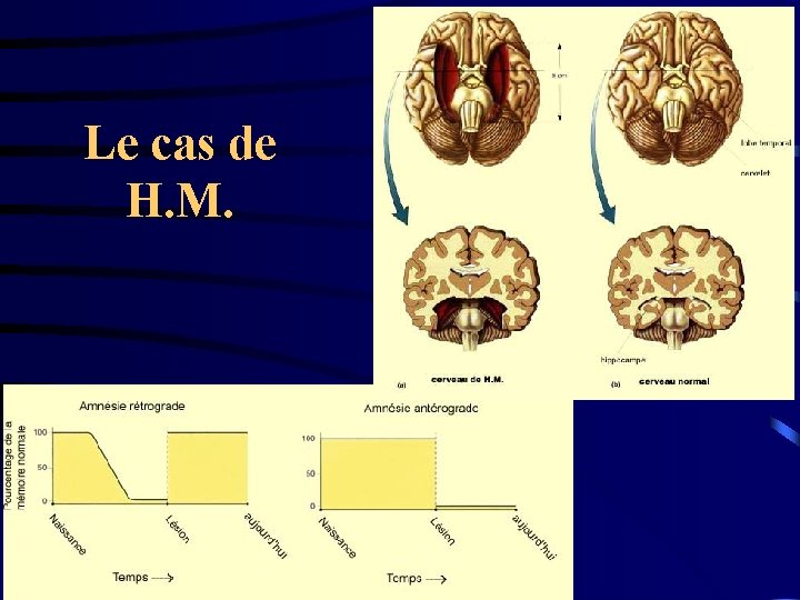Le cas de H. M. 