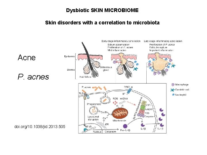 Dysbiotic SKIN MICROBIOME Skin disorders with a correlation to microbiota Acne P. acnes doi.