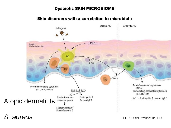 Dysbiotic SKIN MICROBIOME Skin disorders with a correlation to microbiota Atopic dermatitits S. aureus