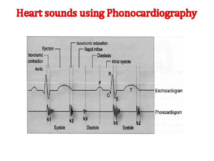 Heart sounds using Phonocardiography 
