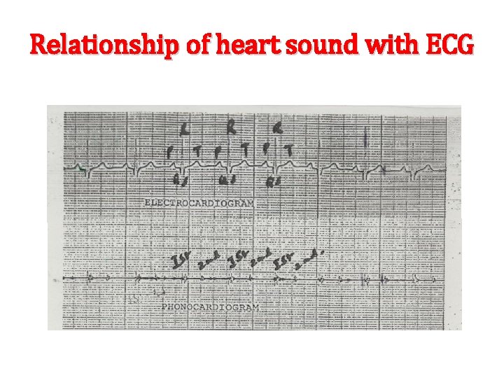 Relationship of heart sound with ECG 