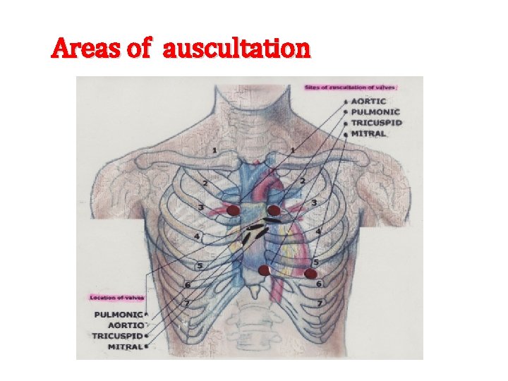 Areas of auscultation 