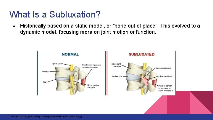 What Is a Subluxation? ● Historically based on a static model, or “bone out