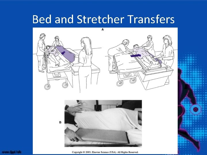 Bed and Stretcher Transfers 