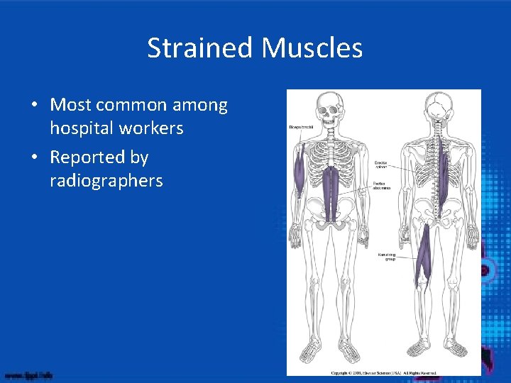 Strained Muscles • Most common among hospital workers • Reported by radiographers 
