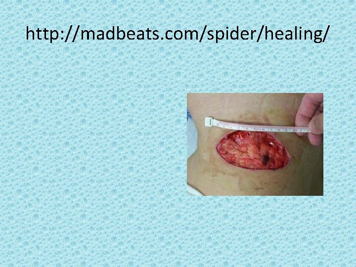 http: //madbeats. com/spider/healing/ 