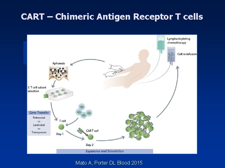 CART – Chimeric Antigen Receptor T cells Mato A, Porter DL Blood 2015 