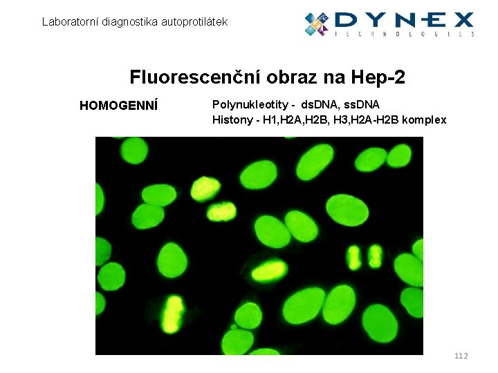 Laboratorní diagnostika autoprotilátek Fluorescenční obraz na Hep-2 HOMOGENNÍ Polynukleotity - ds. DNA, ss. DNA