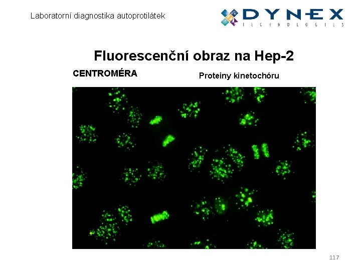Laboratorní diagnostika autoprotilátek Fluorescenční obraz na Hep-2 CENTROMÉRA Proteiny kinetochóru 117 