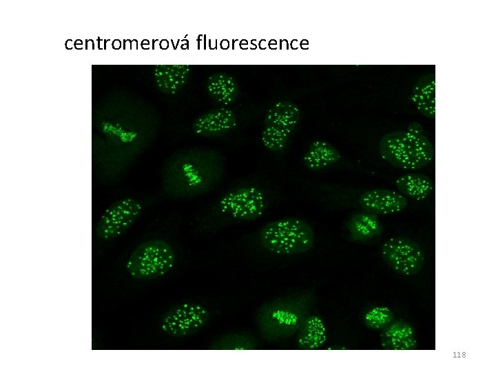 centromerová fluorescence 118 