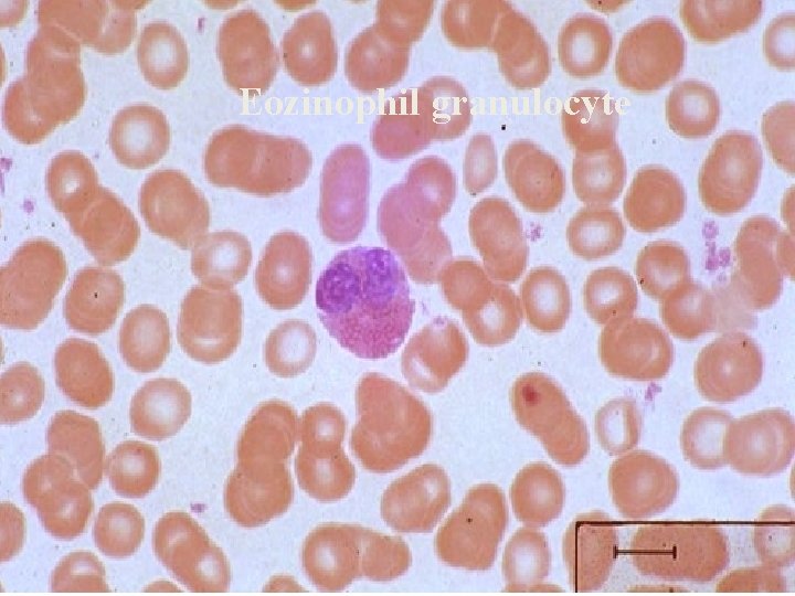 Eozinophil granulocyte 