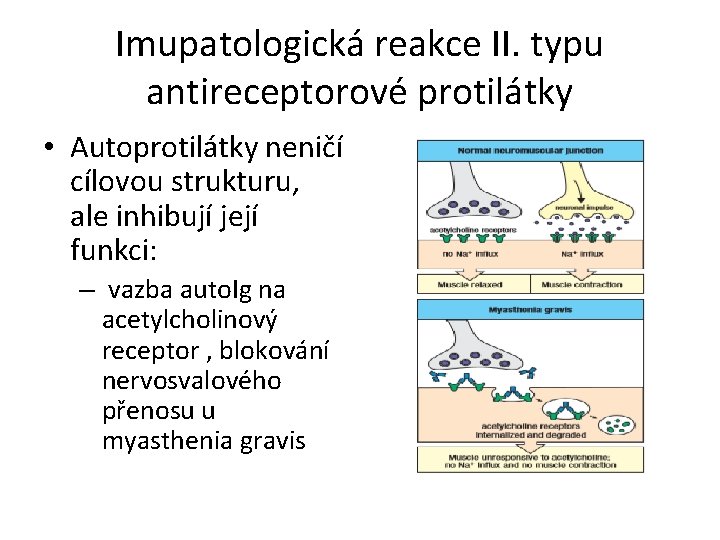 Imupatologická reakce II. typu antireceptorové protilátky • Autoprotilátky neničí cílovou strukturu, ale inhibují její