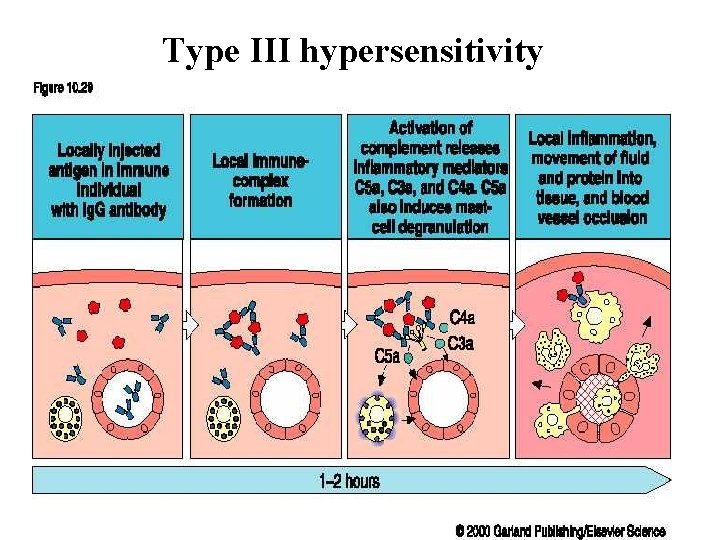 Type III hypersensitivity 