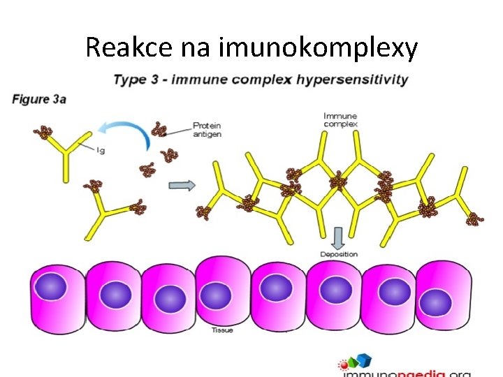 Reakce na imunokomplexy 