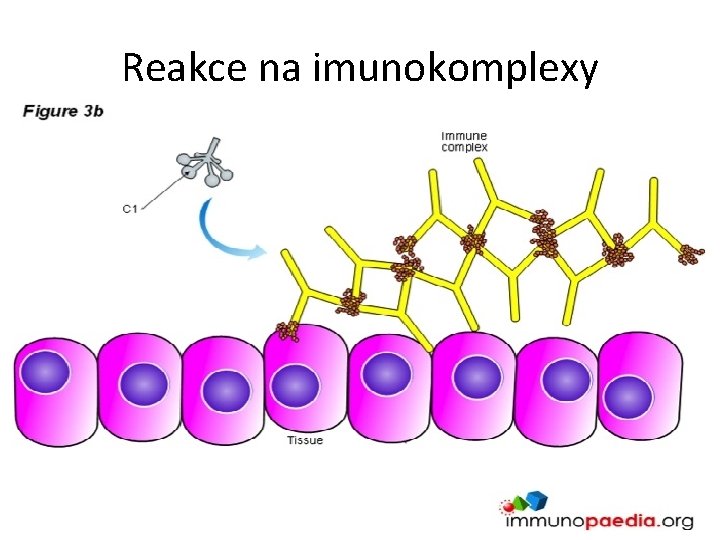 Reakce na imunokomplexy 