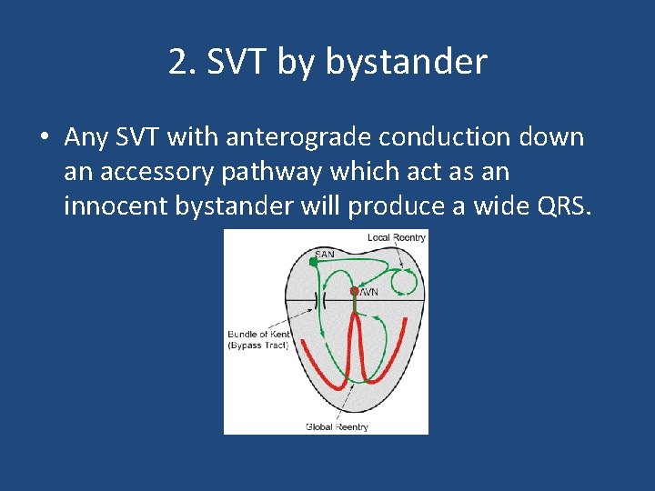 2. SVT by bystander • Any SVT with anterograde conduction down an accessory pathway