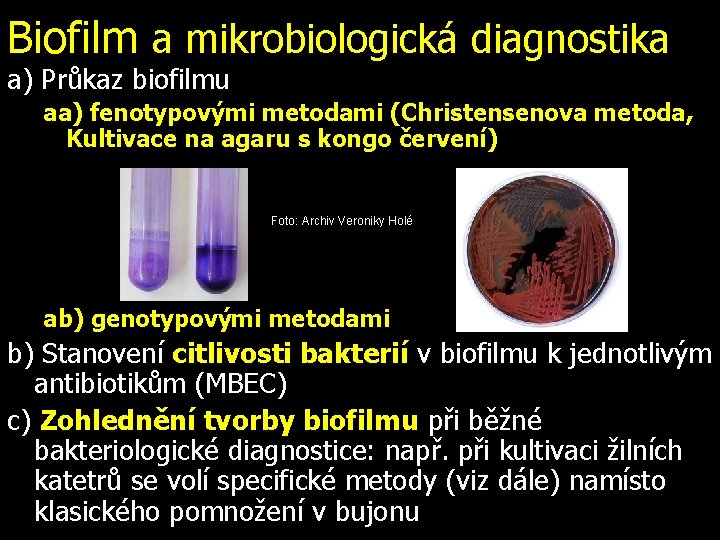 Biofilm a mikrobiologická diagnostika a) Průkaz biofilmu aa) fenotypovými metodami (Christensenova metoda, Kultivace na