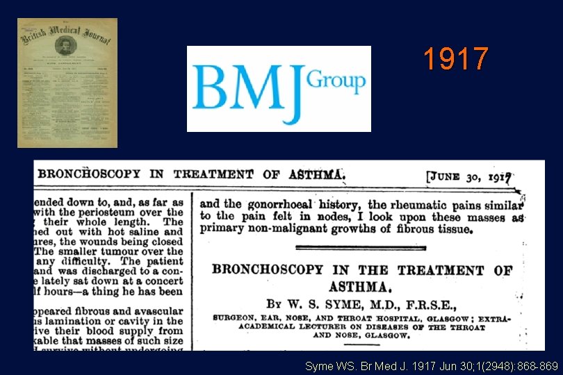 1917 Syme WS. Br Med J. 1917 Jun 30; 1(2948): 868 -869 