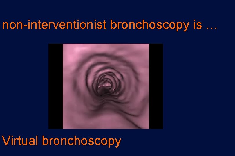 non-interventionist bronchoscopy is … Virtual bronchoscopy 