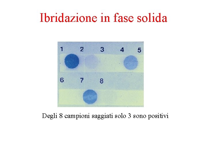 Ibridazione in fase solida Degli 8 campioni saggiati solo 3 sono positivi 