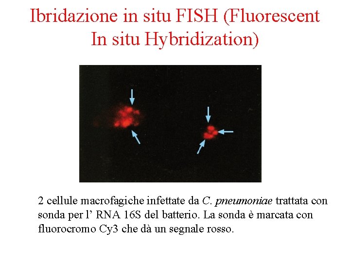 Ibridazione in situ FISH (Fluorescent In situ Hybridization) 2 cellule macrofagiche infettate da C.