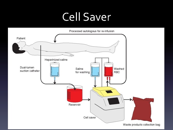 Cell Saver 
