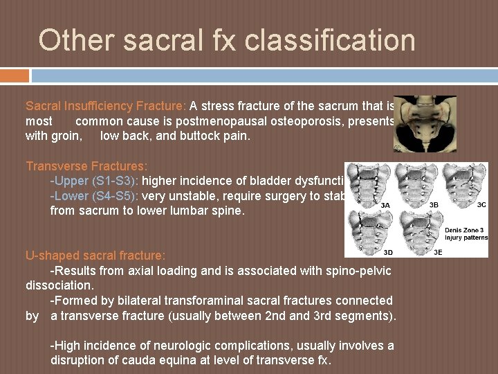 Other sacral fx classification Sacral Insufficiency Fracture: A stress fracture of the sacrum that