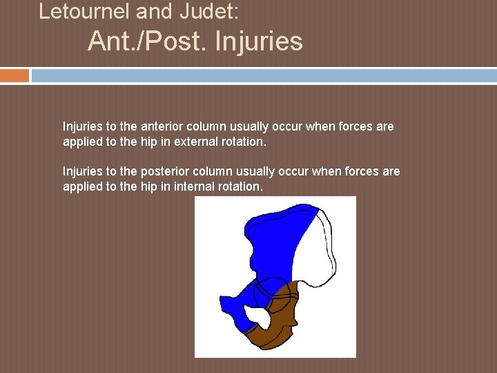 Letournel and Judet: Ant. /Post. Injuries to the anterior column usually occur when forces