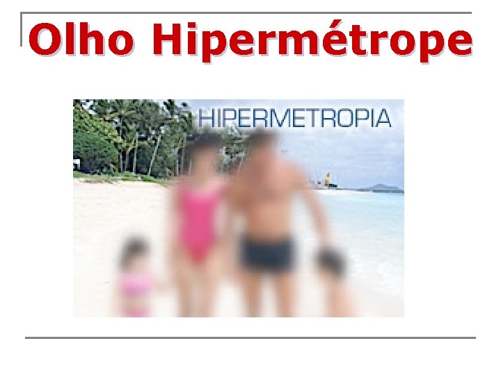 Olho Hipermétrope 