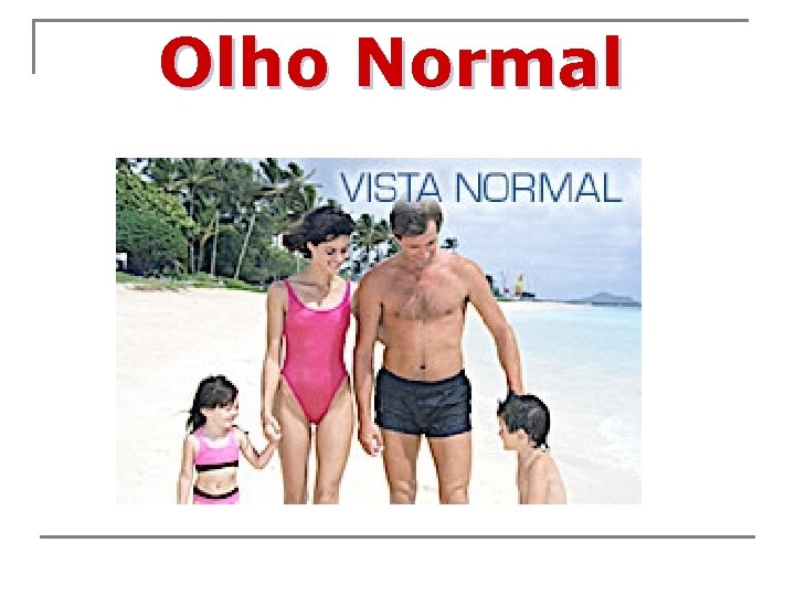 Olho Normal 