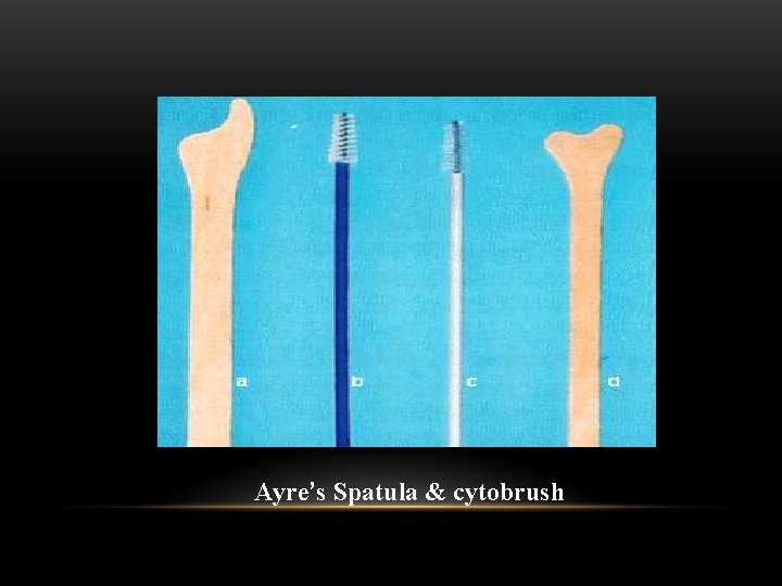 Ayre’s Spatula & cytobrush 
