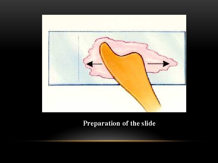 Preparation of the slide 
