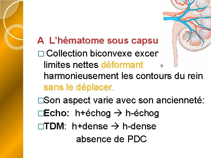 A L’hématome sous capsulaire � Collection biconvexe excentrée, à limites nettes déformant harmonieusement les