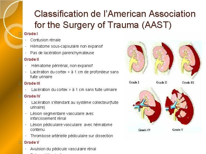 Classification de l’American Association for the Surgery of Trauma (AAST) � Grade I ◦