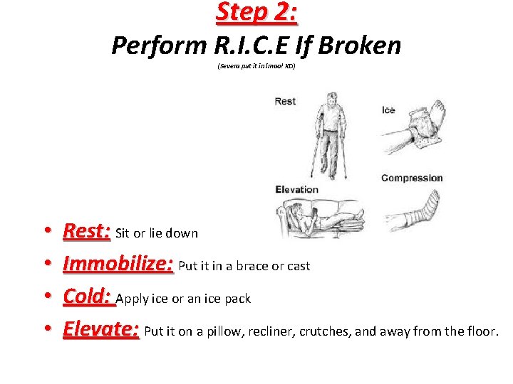 Step 2: Perform R. I. C. E If Broken (Severa put it in lmao!