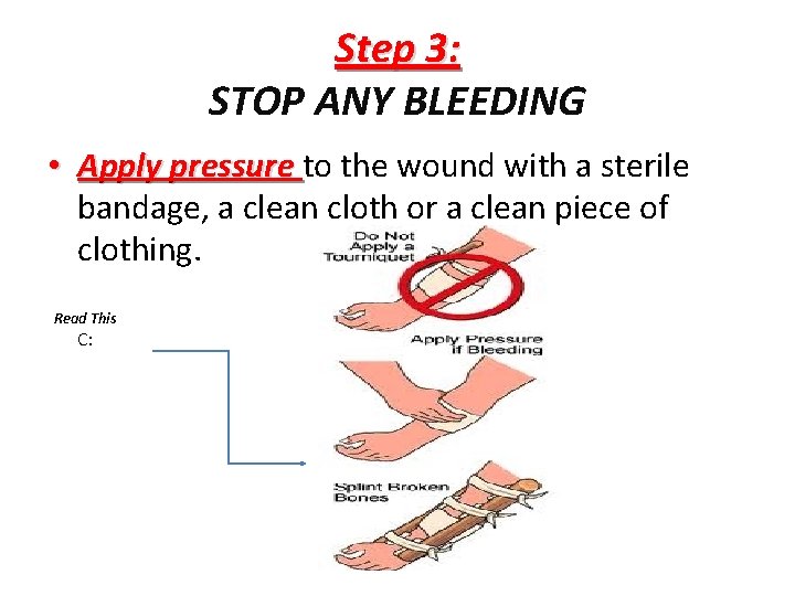 Step 3: STOP ANY BLEEDING • Apply pressure to the wound with a sterile