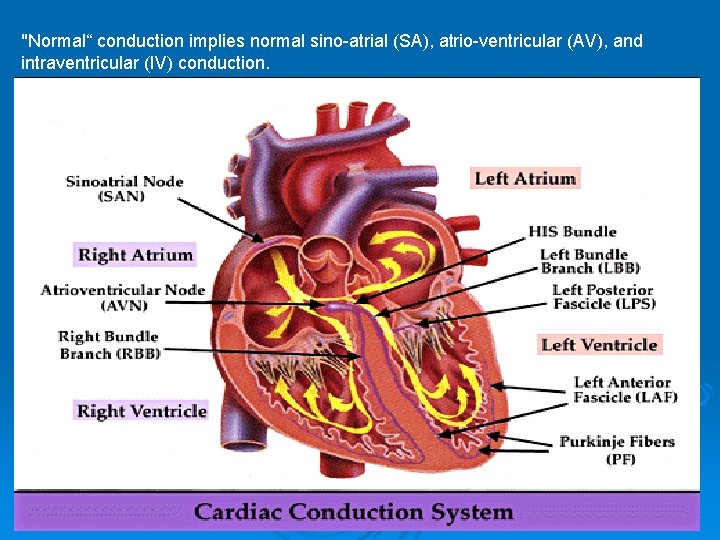 "Normal“ conduction implies normal sino-atrial (SA), atrio-ventricular (AV), and intraventricular (IV) conduction. 