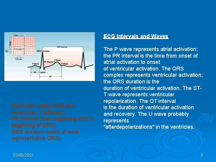 ECG Intervals and Waves Heart rate (state atrial and ventricular, if different) PR interval