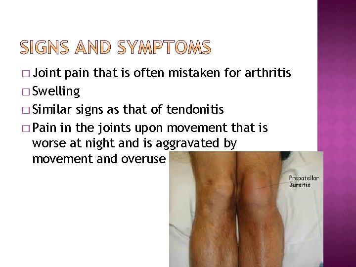 � Joint pain that is often mistaken for arthritis � Swelling � Similar signs