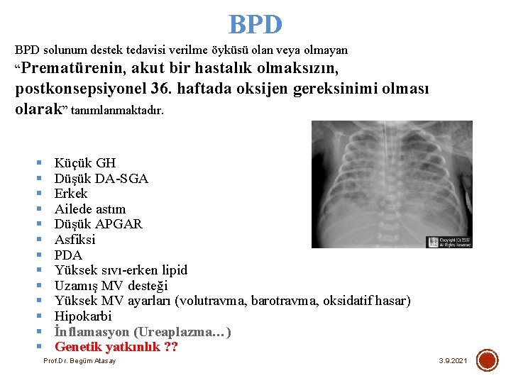 BPD solunum destek tedavisi verilme öyküsü olan veya olmayan “Prematürenin, akut bir hastalık olmaksızın,