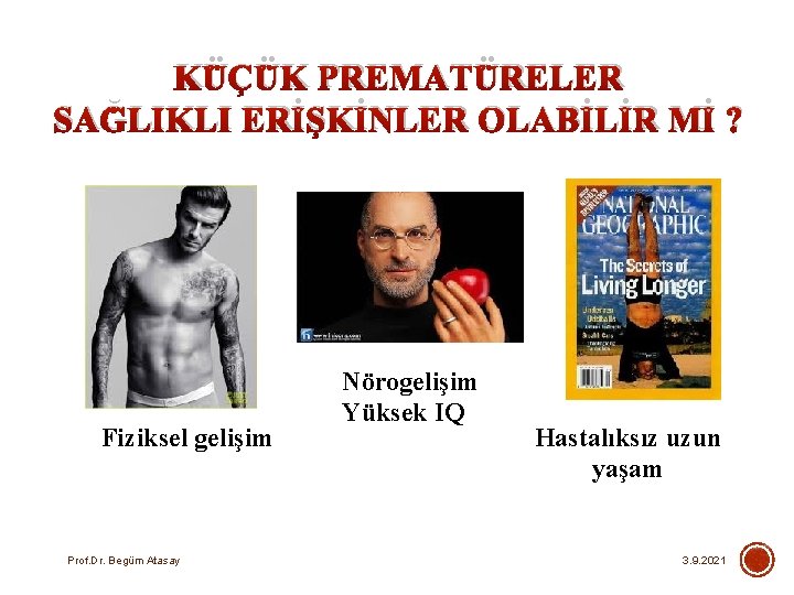 KÜÇÜK PREMATÜRELER SAĞLIKLI ERİŞKİNLER OLABİLİR Mİ ? Fiziksel gelişim Prof. Dr. Begüm Atasay Nörogelişim