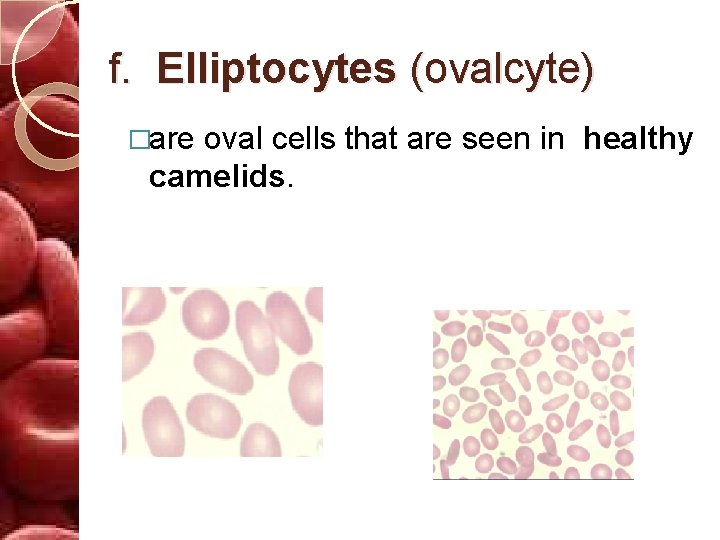 f. Elliptocytes (ovalcyte) �are oval cells that are seen in healthy camelids. 
