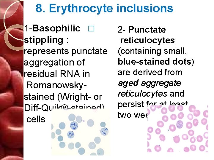 8. Erythrocyte inclusions 1 -Basophilic � stippling : represents punctate aggregation of residual RNA