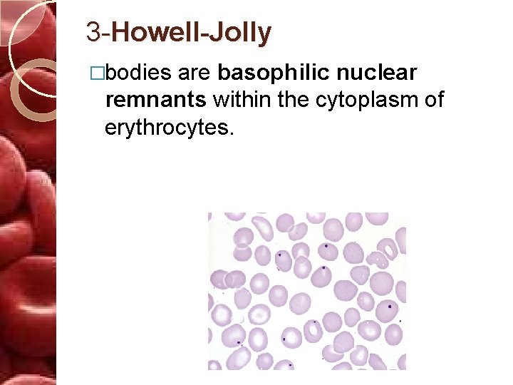 3 -Howell-Jolly �bodies are basophilic nuclear remnants within the cytoplasm of erythrocytes. 
